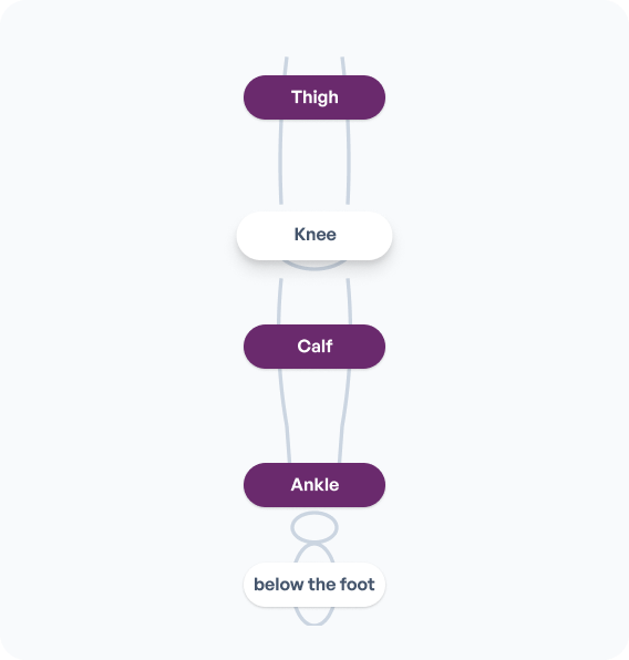 Varicose Veins